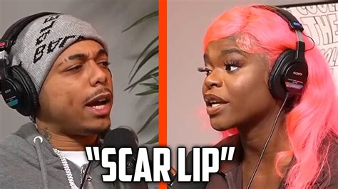 scar lip pussy|Scar Lip